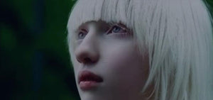 Albinism: Genetics, Causes, and Symptoms