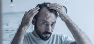 Oxford BIolabs hair loss