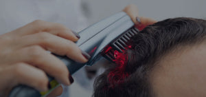 Alternative Hair Loss Treatments: Everything You Need to Know